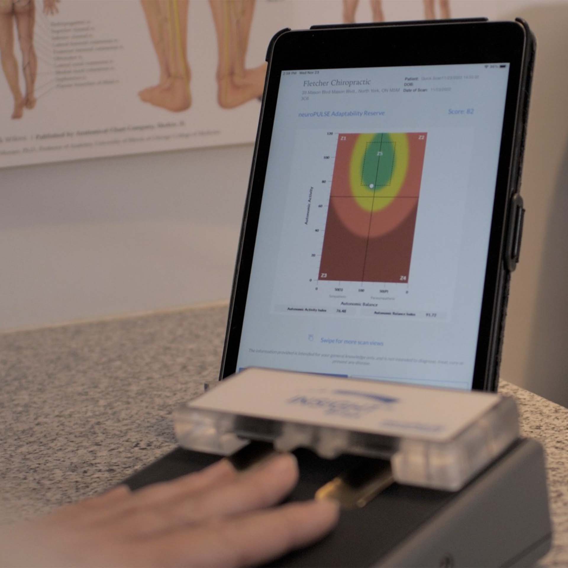 INSiGHT neuroTech (Thermal, EMG, HRV)